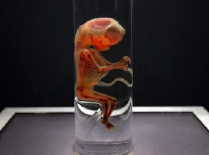 Σε αποχέτευση κτηρίου όπου στεγάζονται γραφεία της ΜΚΟ «Γιατροί Χωρίς Σύνορα» βρέθηκε το ανθρώπινο έμβρυο